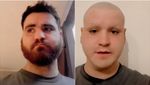 Вболівальник поголив голову, бороду і брови після поразки Англії на Євро-2020: курйозне відео