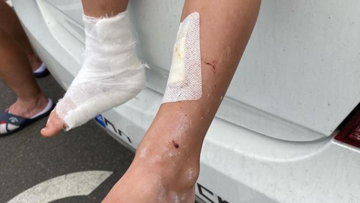 В Киеве Papashon мальчик залез на витрину, а она упала на него В Киеве Papashon мальчик залез на витрину, а она упала на него