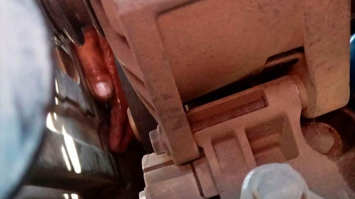 Житель Одещини застряг рукою в моторі: як врятували – фото Житель Одещини застряг рукою в моторі: як врятували – фото