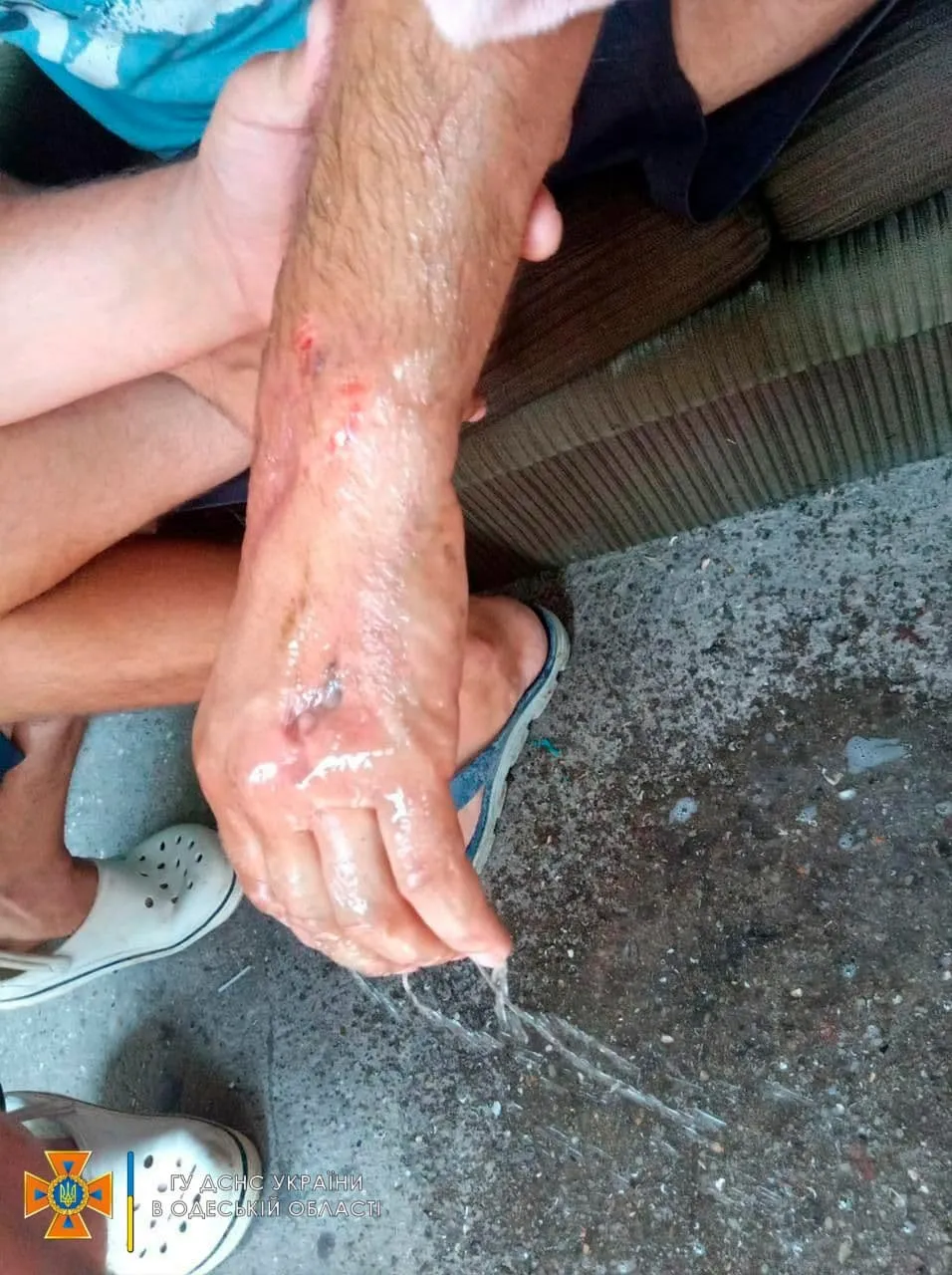 Рука зхастрягла в моторі порятунок ДСНС Рука зхастрягла в моторі порятунок ДСНС