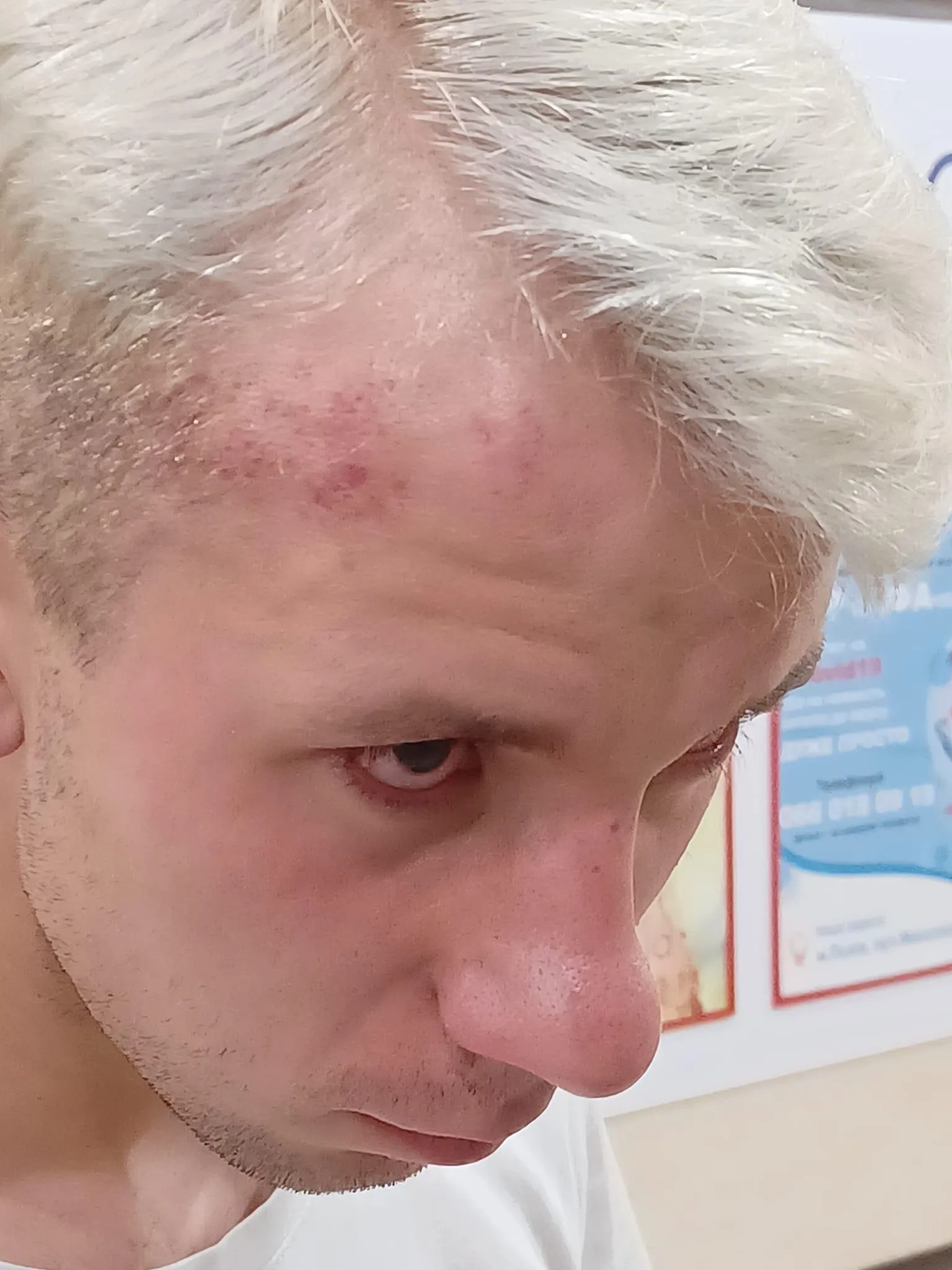 Музиканта і поета побили Новини Львова 26.07.2021 Музиканта і поета побили Новини Львова 26.07.2021