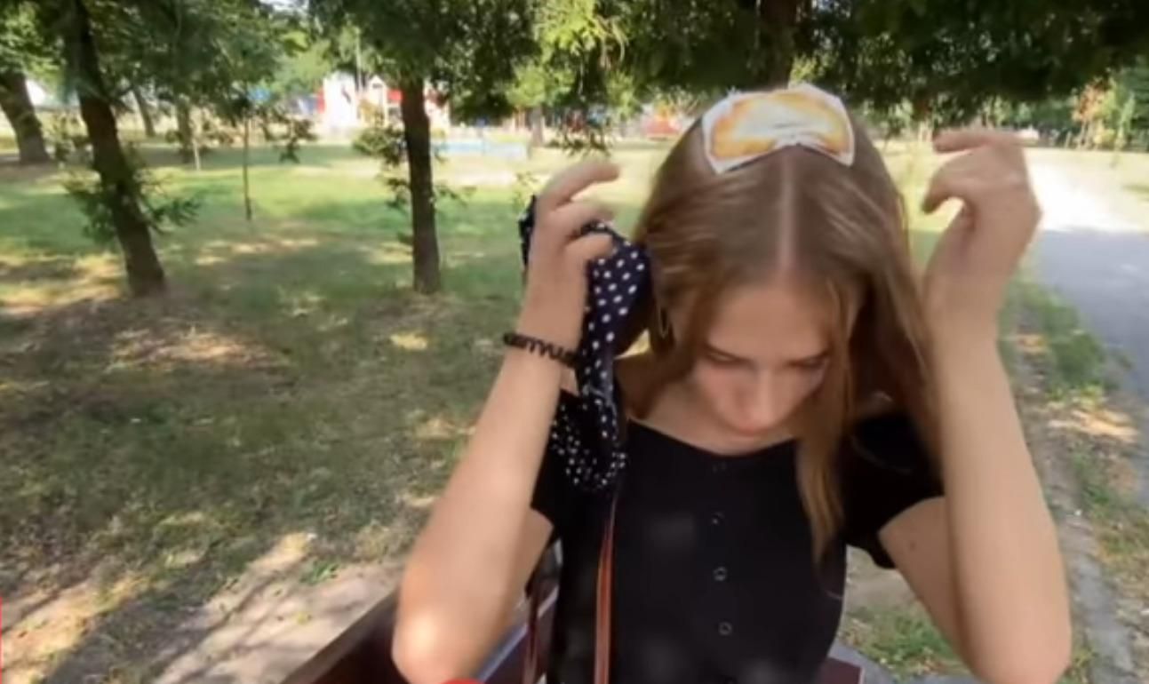 У Сарнах для дівчини похід до перукарки обернувся жахливим опіком У Сарнах для дівчини похід до перукарки обернувся жахливим опіком