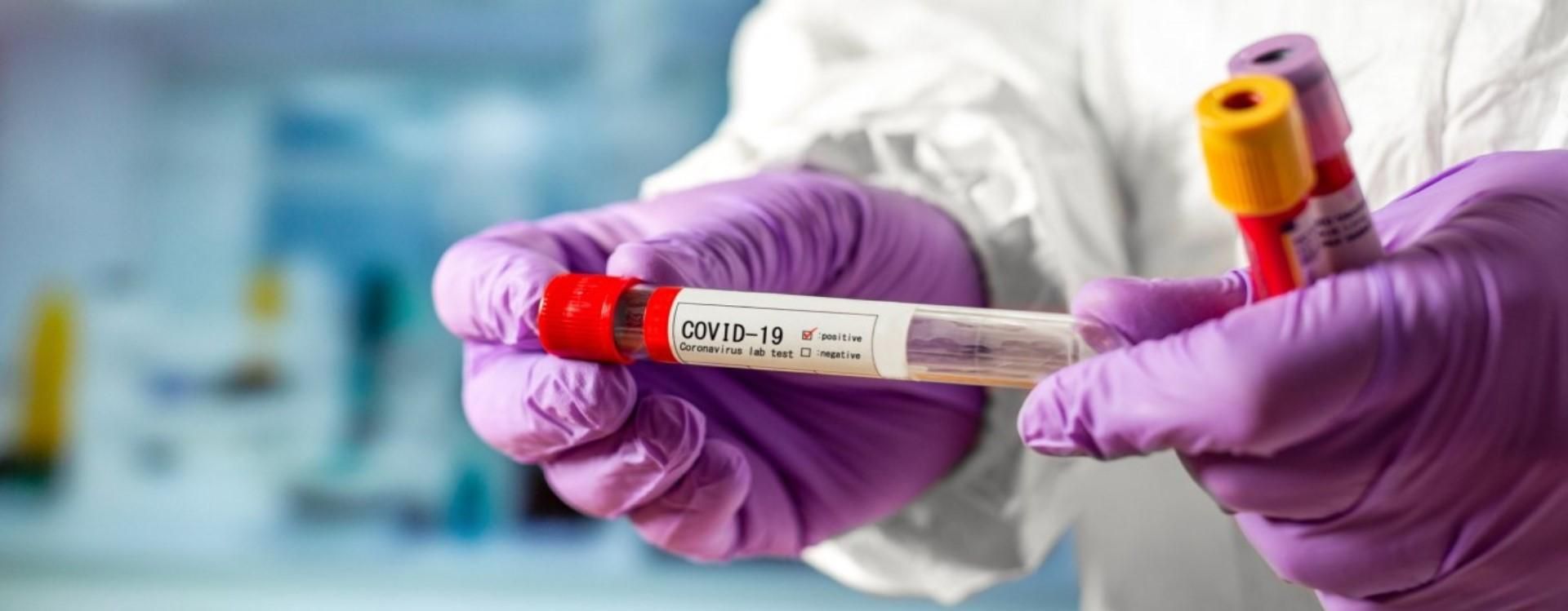 COVID-19 в Україні: госпіталізованих більше, ніж інфікованих