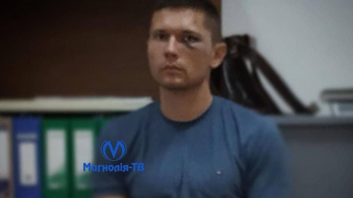 ГБР задержала бойца госохраны, который побил танцора Дорофеевой ГБР задержала бойца госохраны, который побил танцора Дорофеевой