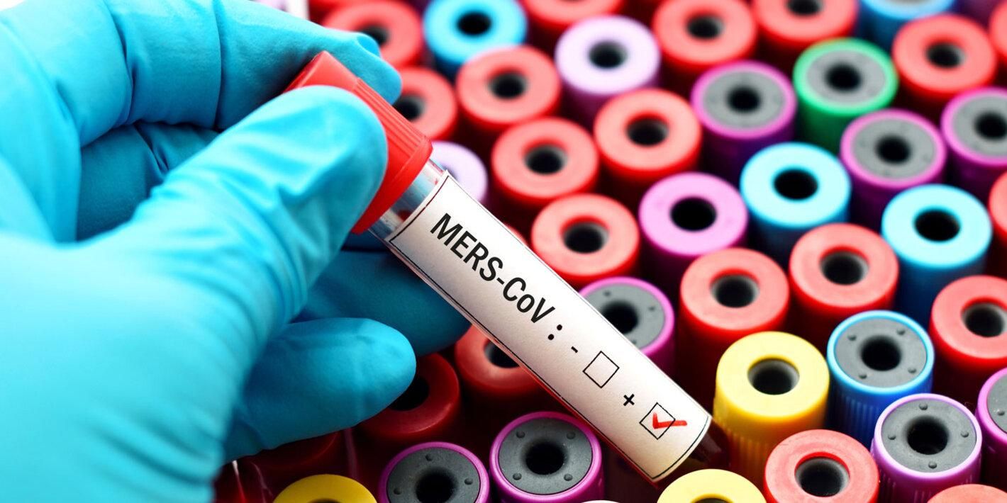 MERS - близькосхідний коронавірус