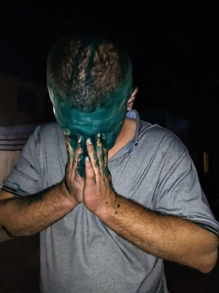 Водій таксі облив зеленкою пасажира в Кам'янському Водій таксі облив зеленкою пасажира в Кам'янському