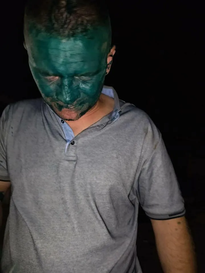 Водій таксі облив зеленкою пасажира в Кам'янському Водій таксі облив зеленкою пасажира в Кам'янському