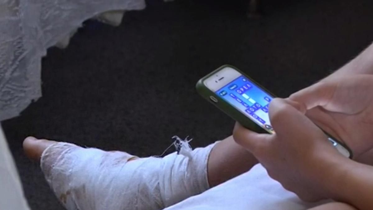 Мальчик прострелил себе ногу винтовкой в Днепре: каково состояние Мальчик прострелил себе ногу винтовкой в Днепре: каково состояние