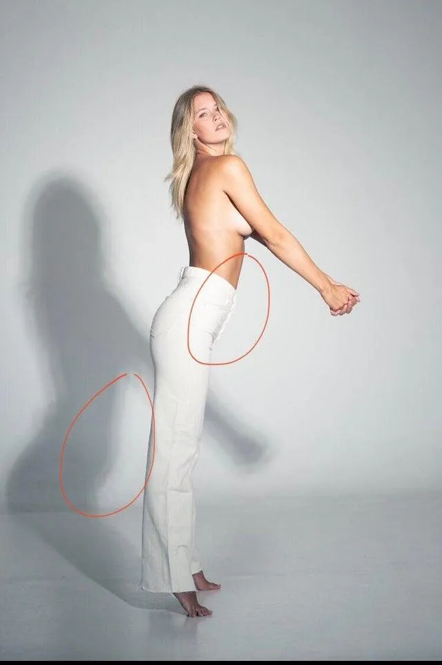 Животик дівчині прибрали, а про тінь забули Животик дівчині прибрали, а про тінь забули