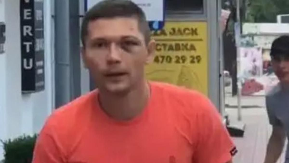 Избиение танцора Дорофеевой: боец УГО не впервые избил человека - СМИ Избиение танцора Дорофеевой: боец УГО не впервые избил человека - СМИ