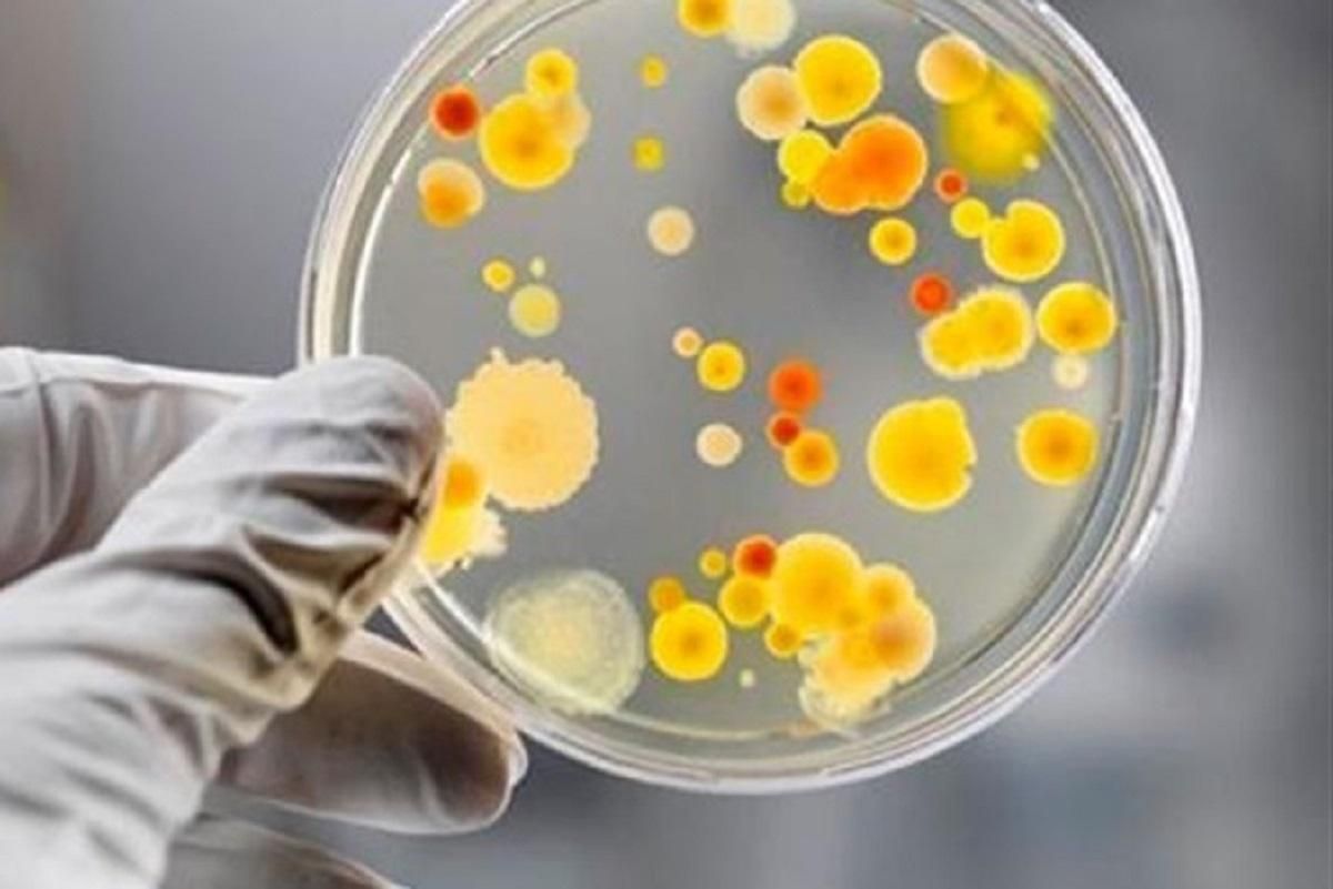 В Белой Церкви обнаружили сальмонеллез в кафе В Белой Церкви обнаружили сальмонеллез в кафе