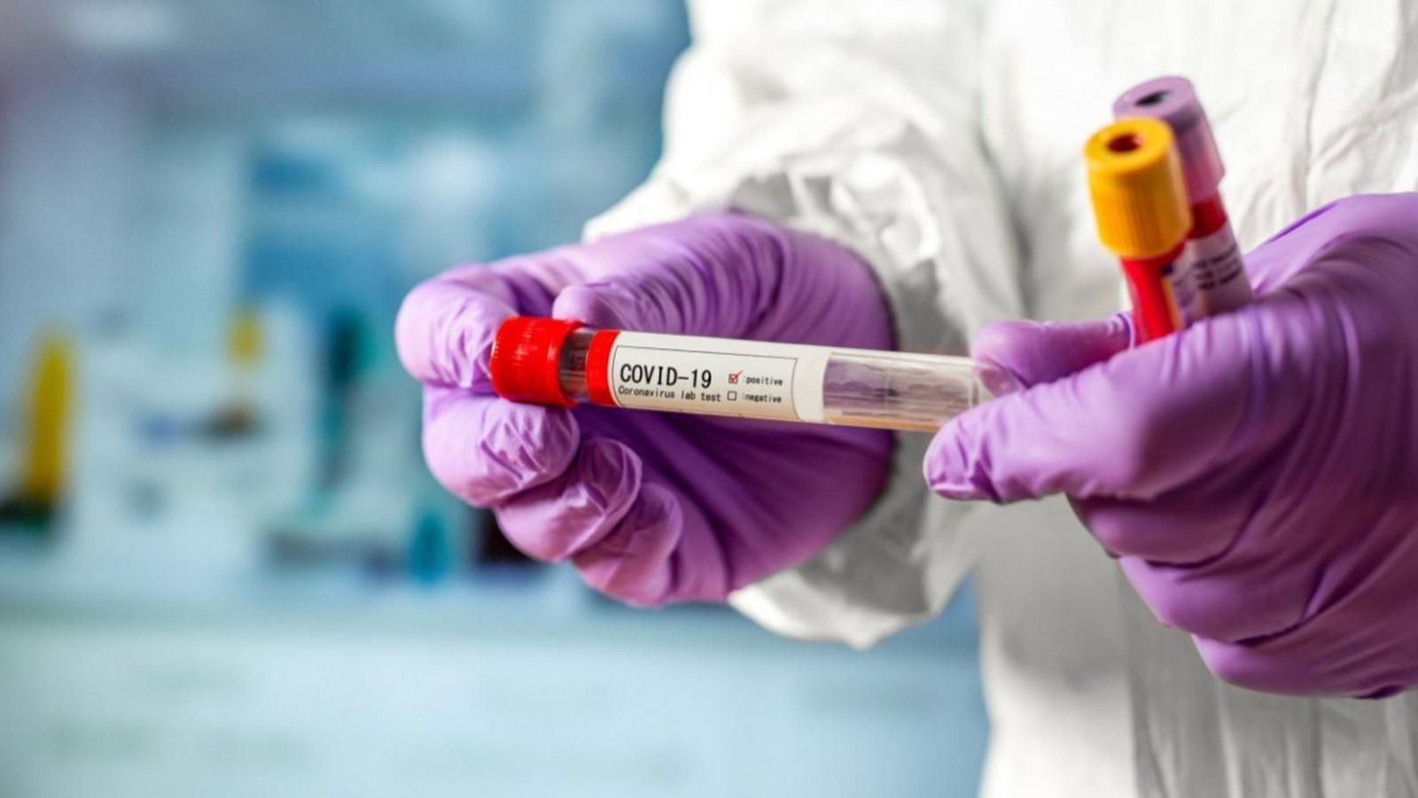 На Тернопільщині невакциновані вчителі будуть щотижня робити ПЛР-тести На Тернопільщині невакциновані вчителі будуть щотижня робити ПЛР-тести