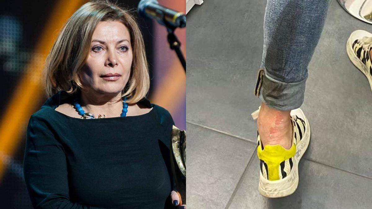 У Києві водій наїхав на журналістку Наталю Влащенко та втік - Новини Києва - Київ У Києві водій наїхав на журналістку Наталю Влащенко та втік - Новини Києва - Київ