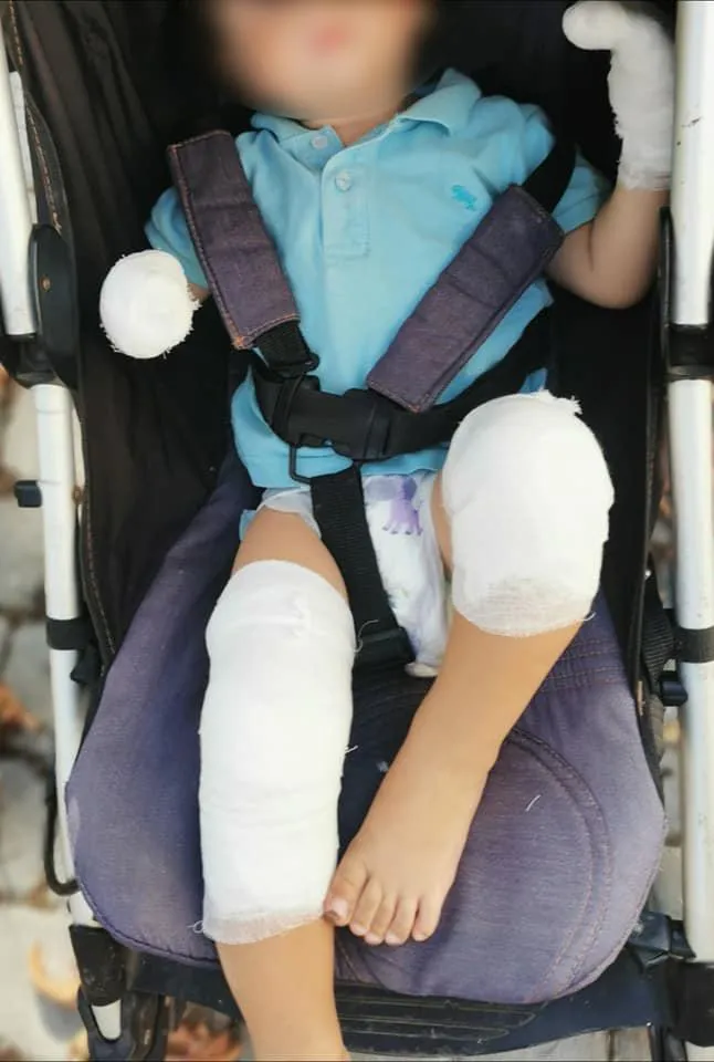 Хлопчик обпікся об пам'ятник в Одесі Хлопчик обпікся об пам'ятник в Одесі