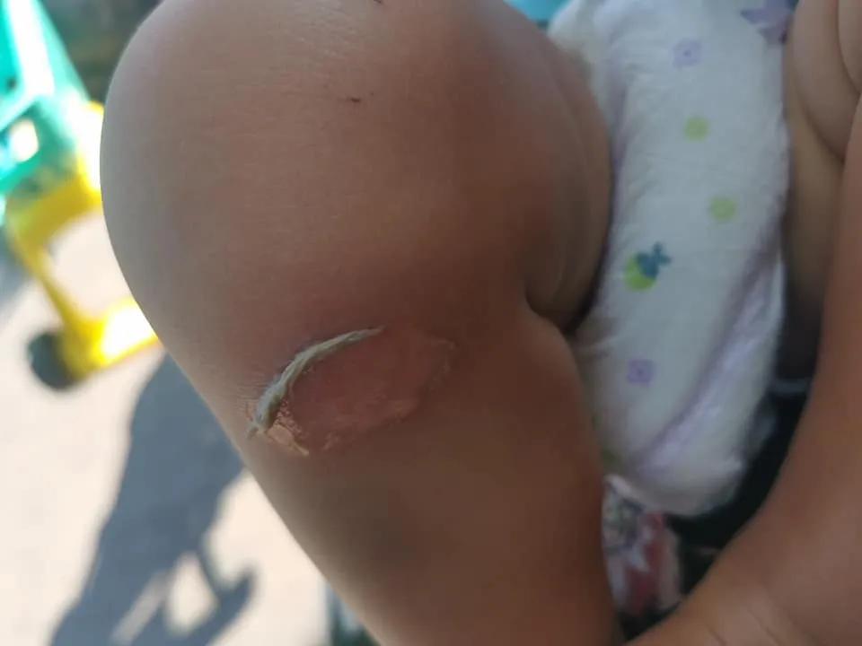 Хлопчик обпікся об пам'ятник в Одесі Хлопчик обпікся об пам'ятник в Одесі