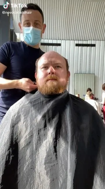 Адам до процедури / Скриншот інстаграм novocabelohair Адам до процедури / Скриншот інстаграм novocabelohair