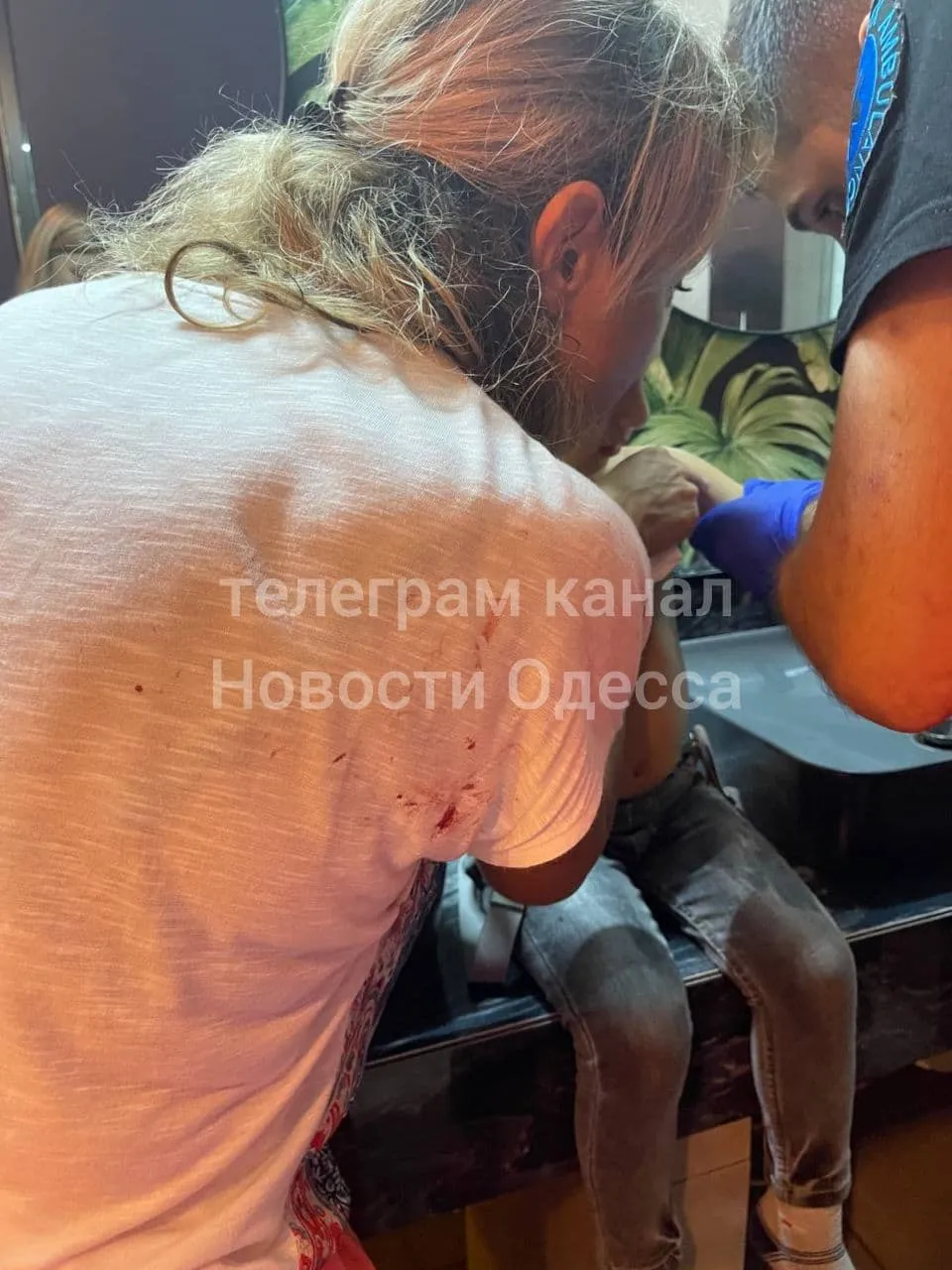 На дитину в Одесі впали скляні двері На дитину в Одесі впали скляні двері