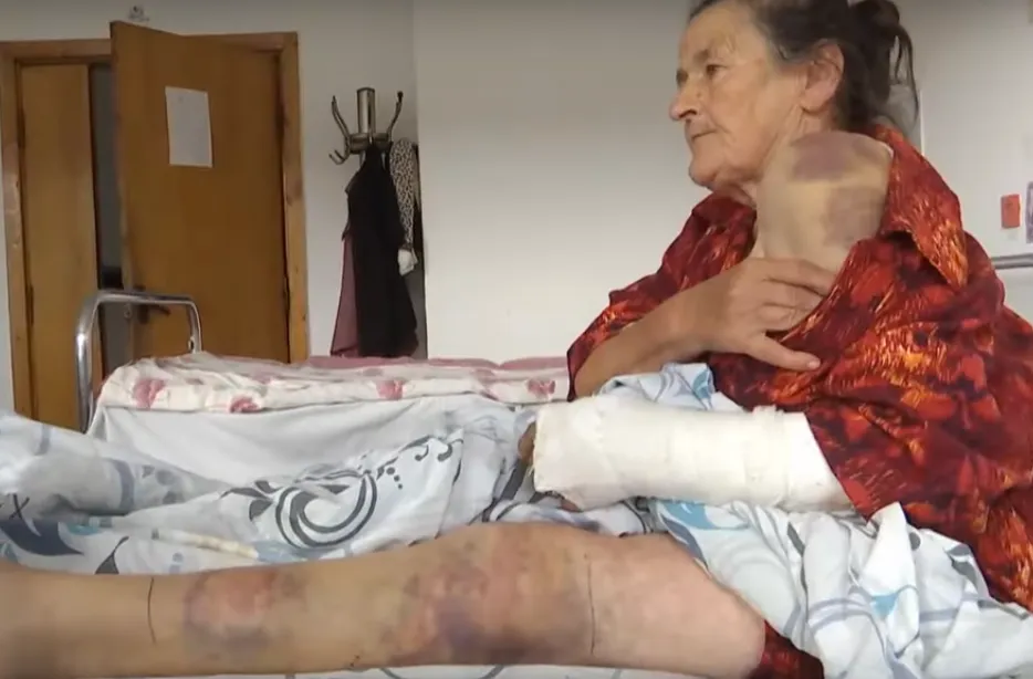 Аж поламав палицю: на Львівщині староста села жорстоко побив пенсіонерку через корову Аж поламав палицю: на Львівщині староста села жорстоко побив пенсіонерку через корову