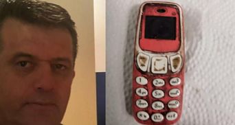 Мужчина в Косово проглотил телефон: как врачи его спасали – неожиданные фото