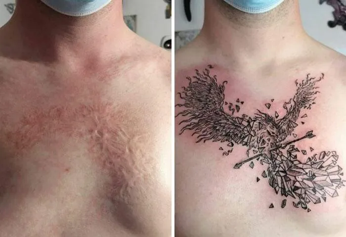 Тату, что скрывают шрамы Тату, что скрывают шрамы