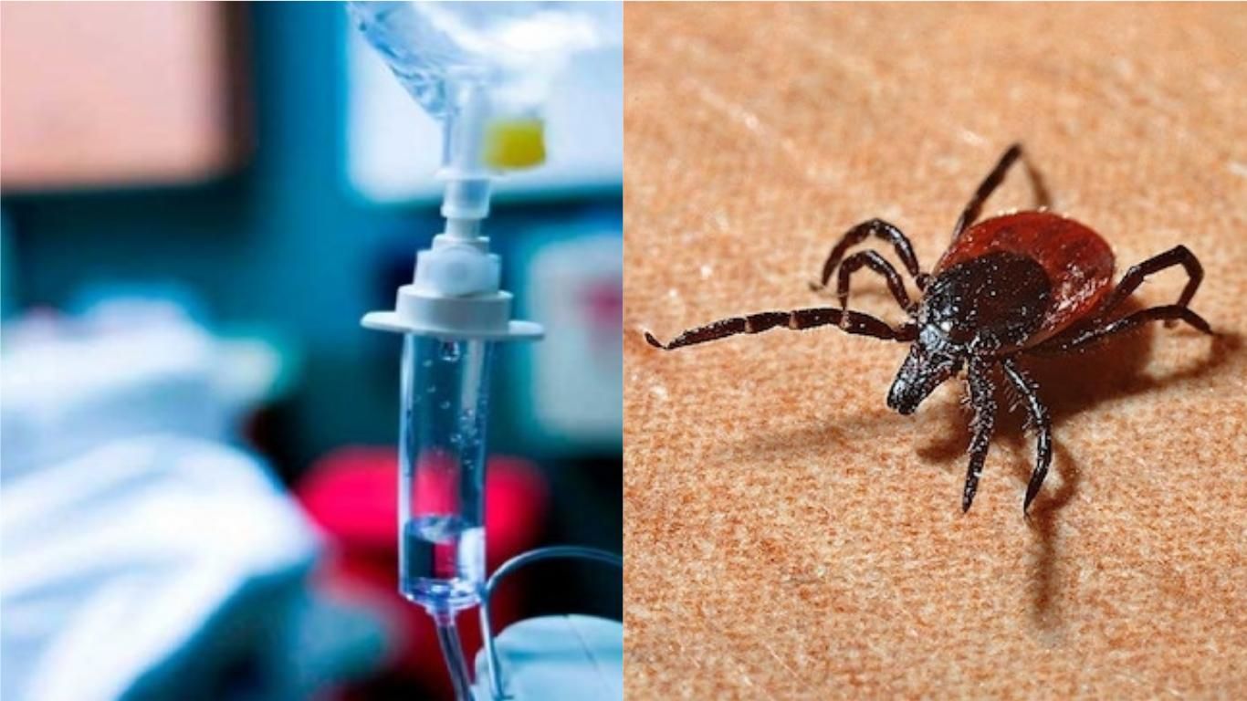 В Одесской области ребенка парализовало после укуса клеща В Одесской области ребенка парализовало после укуса клеща