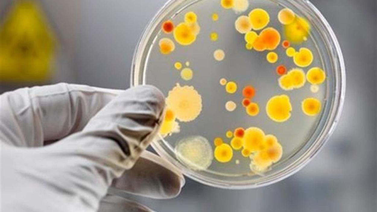 На Львовщину завезли зараженную сальмонеллой польскую курятину На Львовщину завезли зараженную сальмонеллой польскую курятину