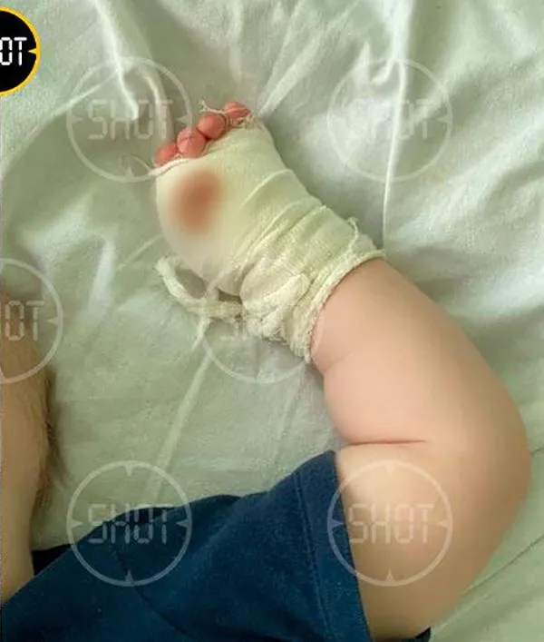 тигр відкусив дитині палець в кримському зоопарку тигр відкусив дитині палець в кримському зоопарку