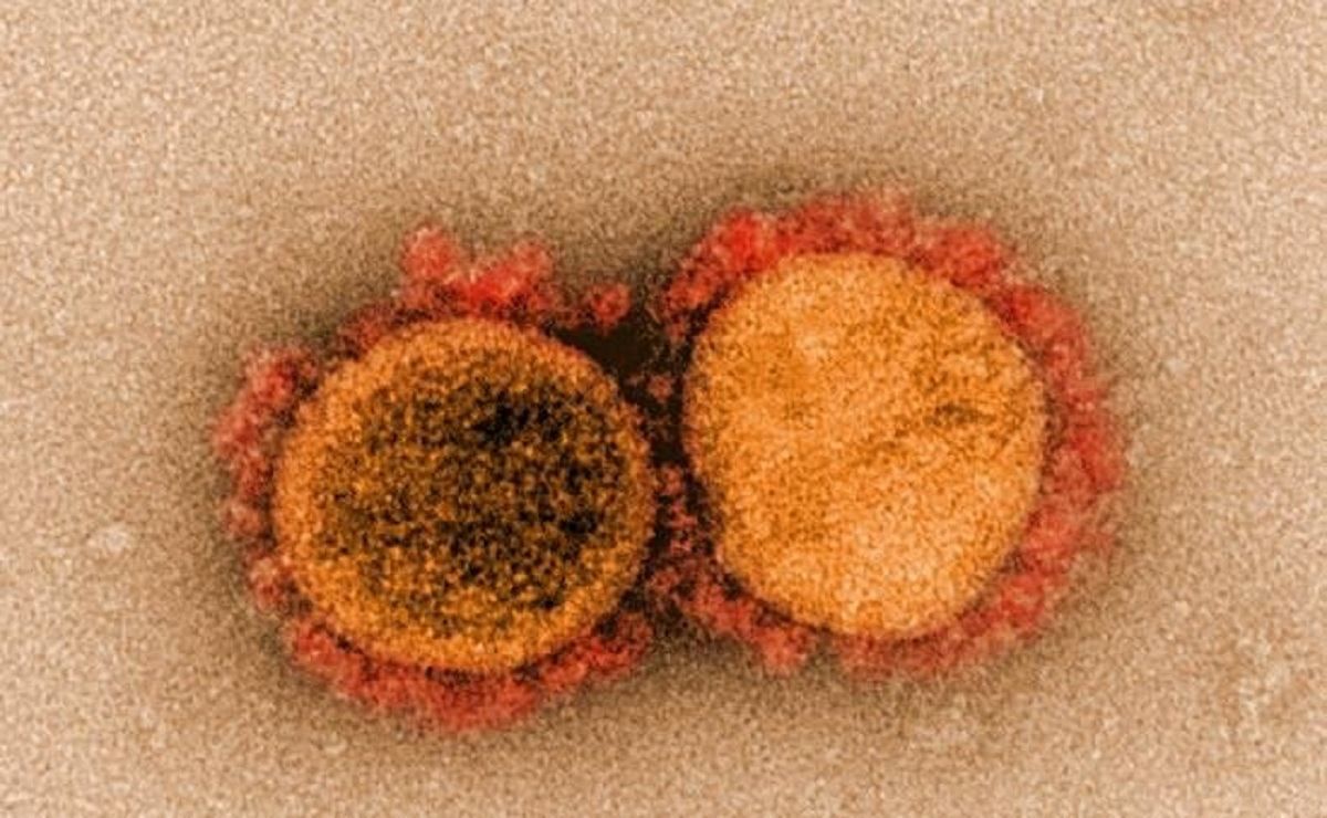 Почему некоторые люди менее устойчивы к COVID-19