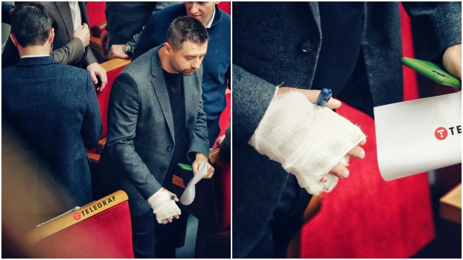 После вечеринки "слуг" в Трускавце: нардеп Арахамия пришел в Раду с гипсом После вечеринки "слуг" в Трускавце: нардеп Арахамия пришел в Раду с гипсом