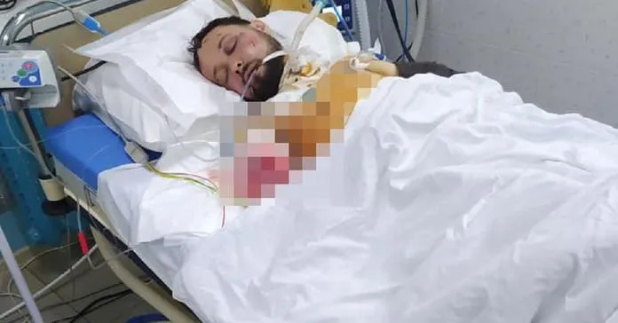 Помер 31-річний львів'янин, який впав з моста і потрапив під потяг