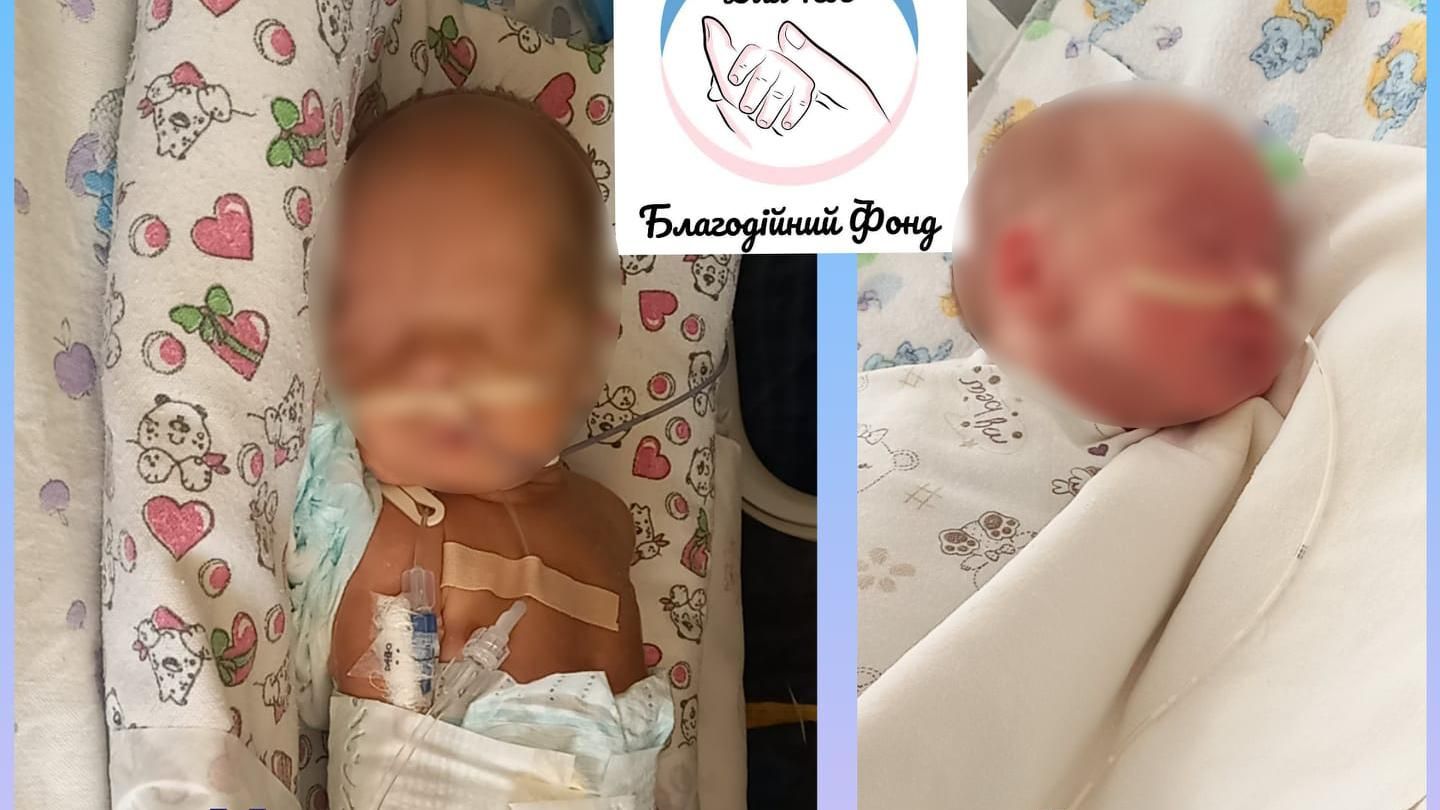 Мама не приходить вже місяць: у Дніпрі рятують двійнят у важкому стані - Новини Дніпра - 24 Канал Мама не приходить вже місяць: у Дніпрі рятують двійнят у важкому стані - Новини Дніпра - 24 Канал