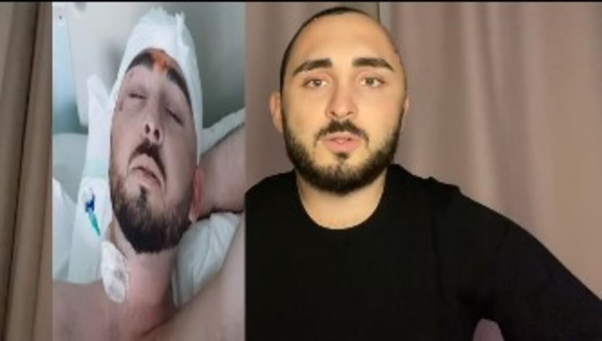 Попросив цигарку і лишився без частини черепа: у Києві жорстоко побили інстраграм-блогера - 20 октября 2021 - Киев Попросив цигарку і лишився без частини черепа: у Києві жорстоко побили інстраграм-блогера - 20 октября 2021 - Киев