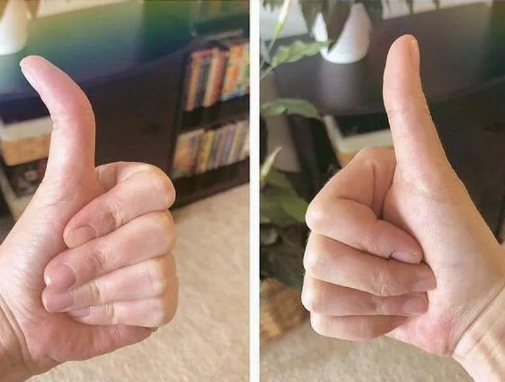 "Мені за тридцять, і я тільки що зрозумів у мене нерівні великі пальці..." "Мені за тридцять, і я тільки що зрозумів у мене нерівні великі пальці..."