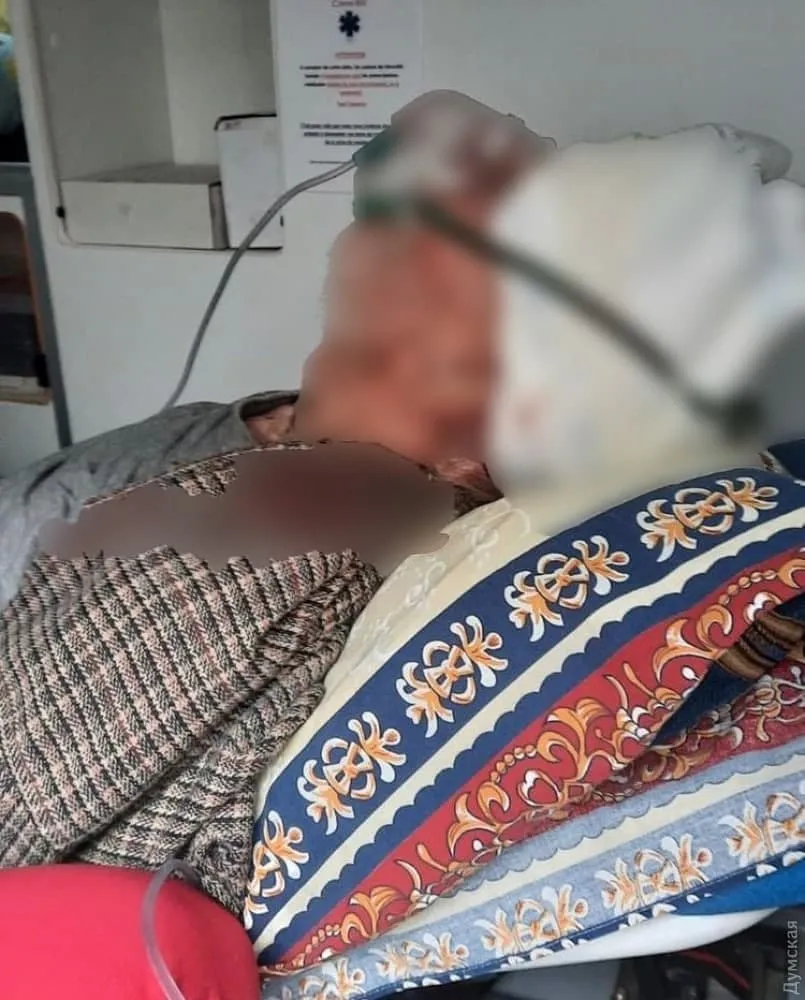 Коронавірус Хворий Одесит Дідусь Травма голови Помер 2 листопада 2021 Коронавірус Хворий Одесит Дідусь Травма голови Помер 2 листопада 2021