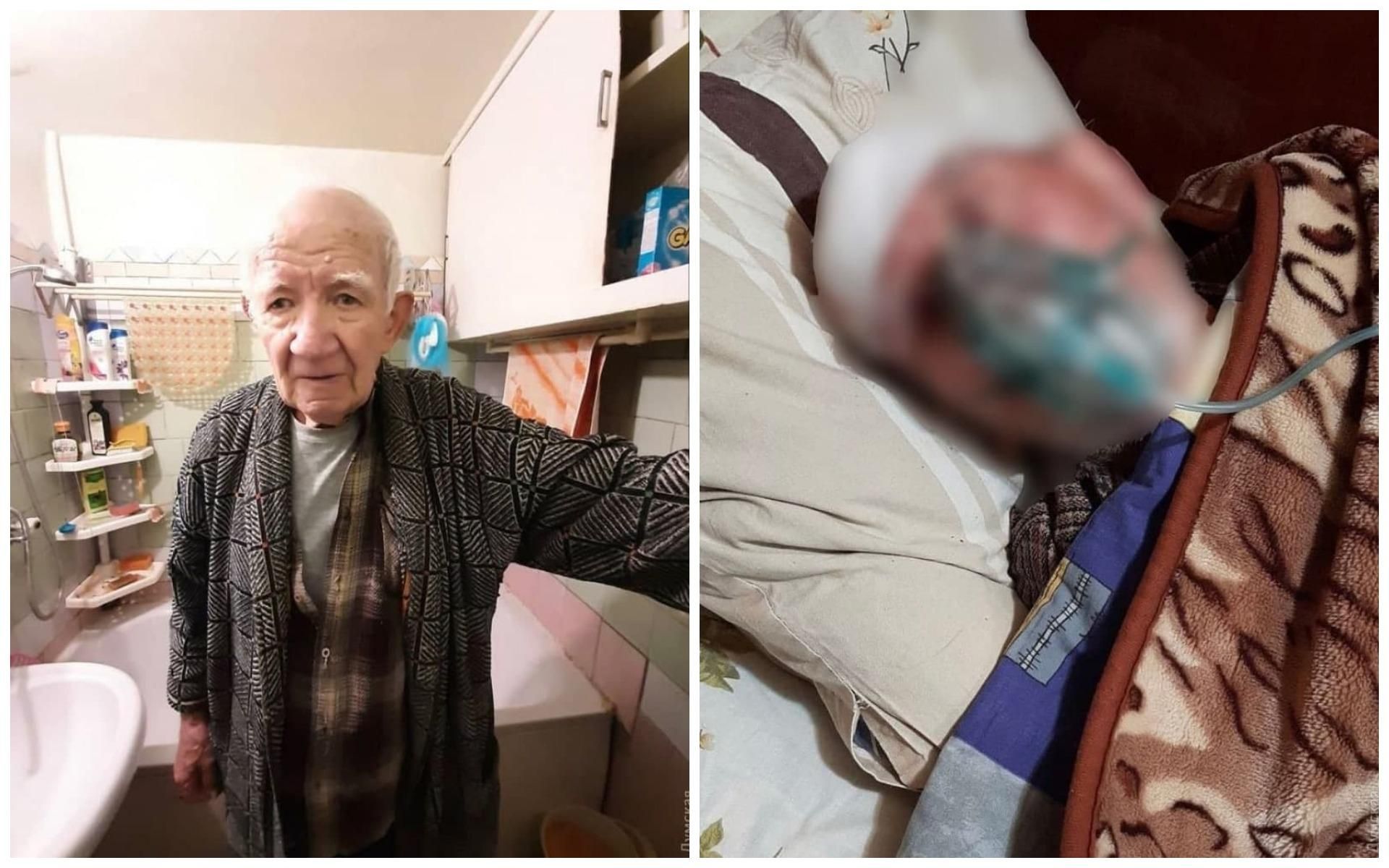 Больного коронавирусом одессита с травмой головы выписали из больницы: через день он умер Больного коронавирусом одессита с травмой головы выписали из больницы: через день он умер