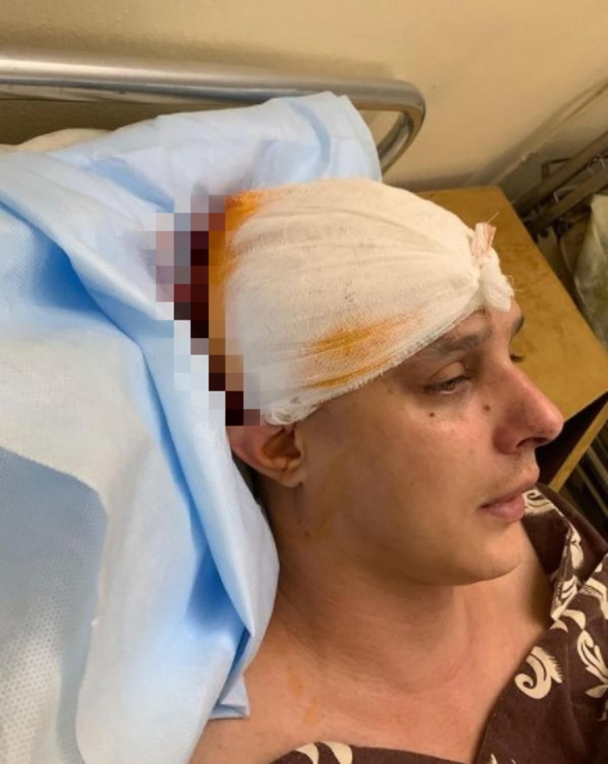 У Києві жорстоко побили автора пісень гурту KAZKA - Київ У Києві жорстоко побили автора пісень гурту KAZKA - Київ