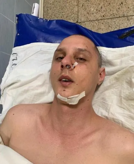 У Києві напали на Миколу Журавльова, автору пісень для KAZKA проломили голову