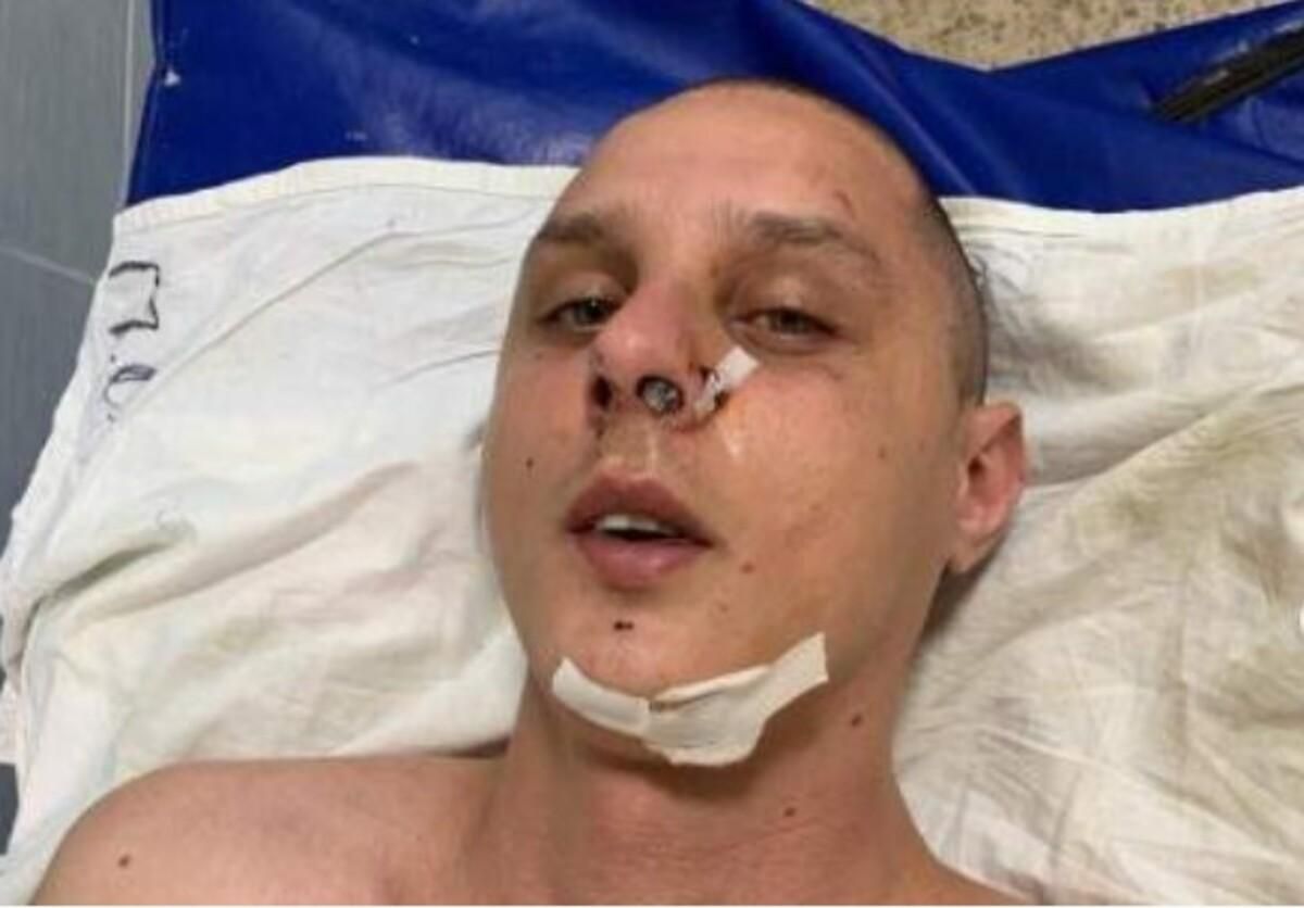 Проломив голову й утік: підозрюваного в побитті автора пісень KAZKA затримали - Київ