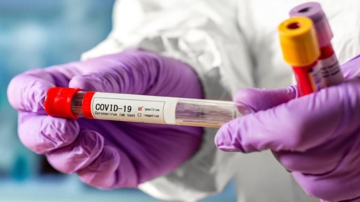 У Києві суттєво знизилася кількість нових випадків інфікування COVID-19 - Новини Київ - Київ У Києві суттєво знизилася кількість нових випадків інфікування COVID-19 - Новини Київ - Київ