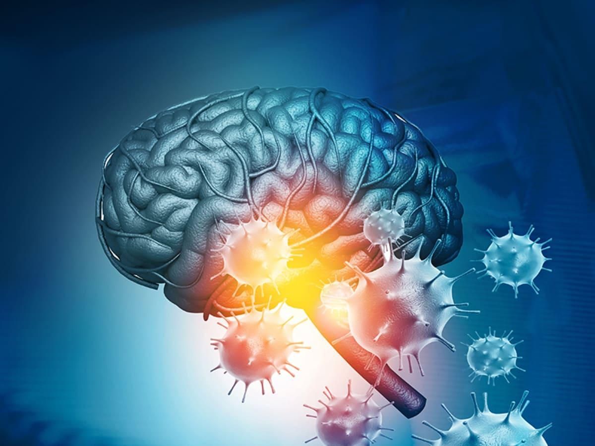 "Туман" в голове после COVID-19: как вирус попадает в мозг и чем это грозит