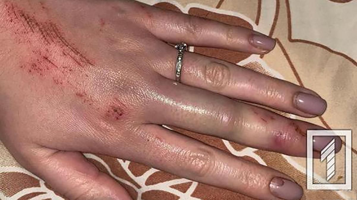 В Кривом Роге таксист напал на пассажирку: вытащил из авто и душил В Кривом Роге таксист напал на пассажирку: вытащил из авто и душил