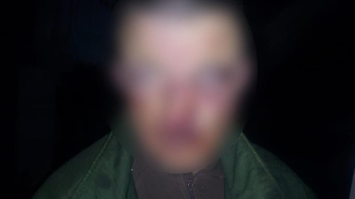 На Київщині браконьєр підстрелив 19-річного хлопця, його затримали - Київ