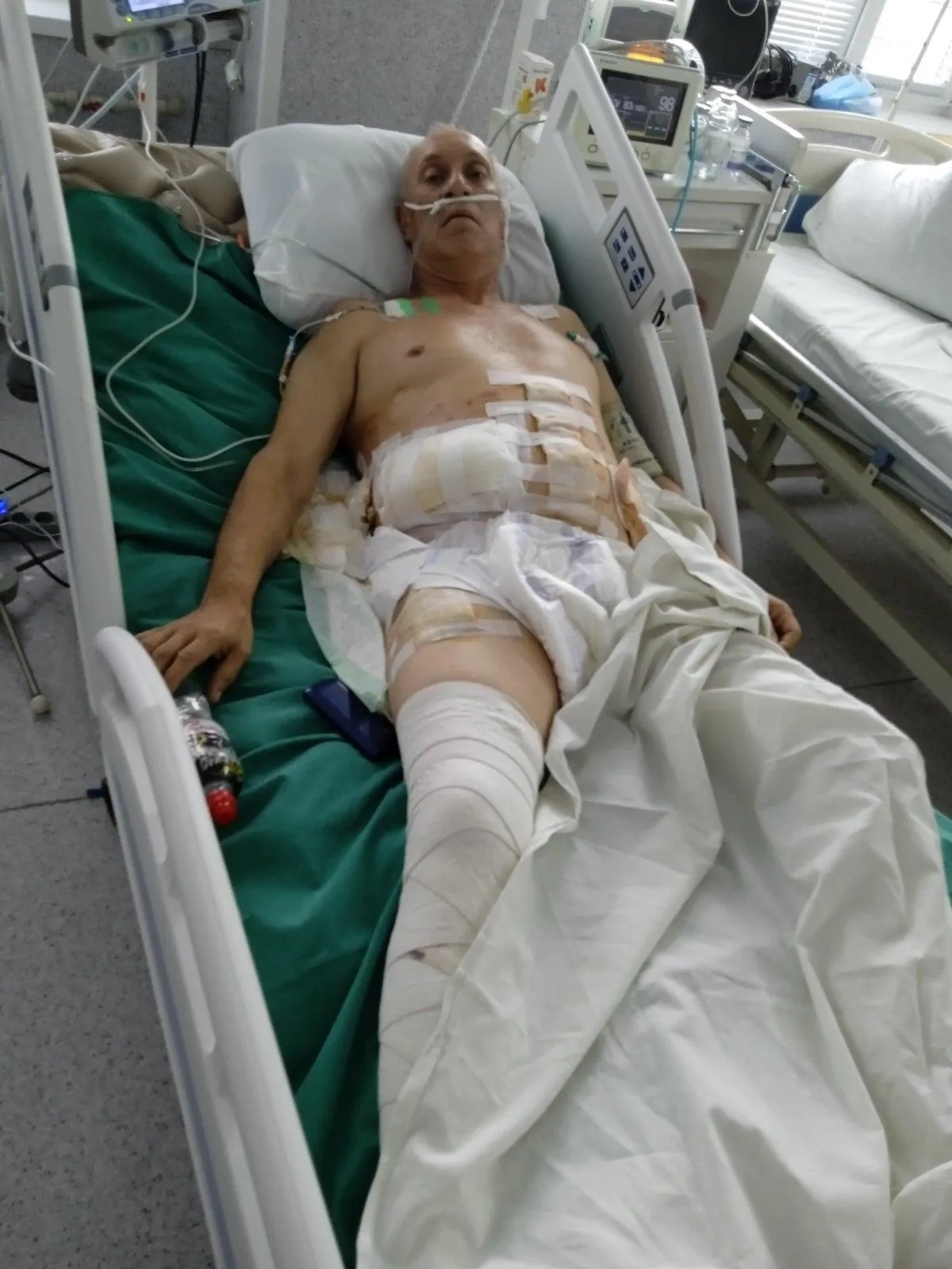 Медики борються за життя важкопораненого воїна з Львівщини Медики борються за життя важкопораненого воїна з Львівщини