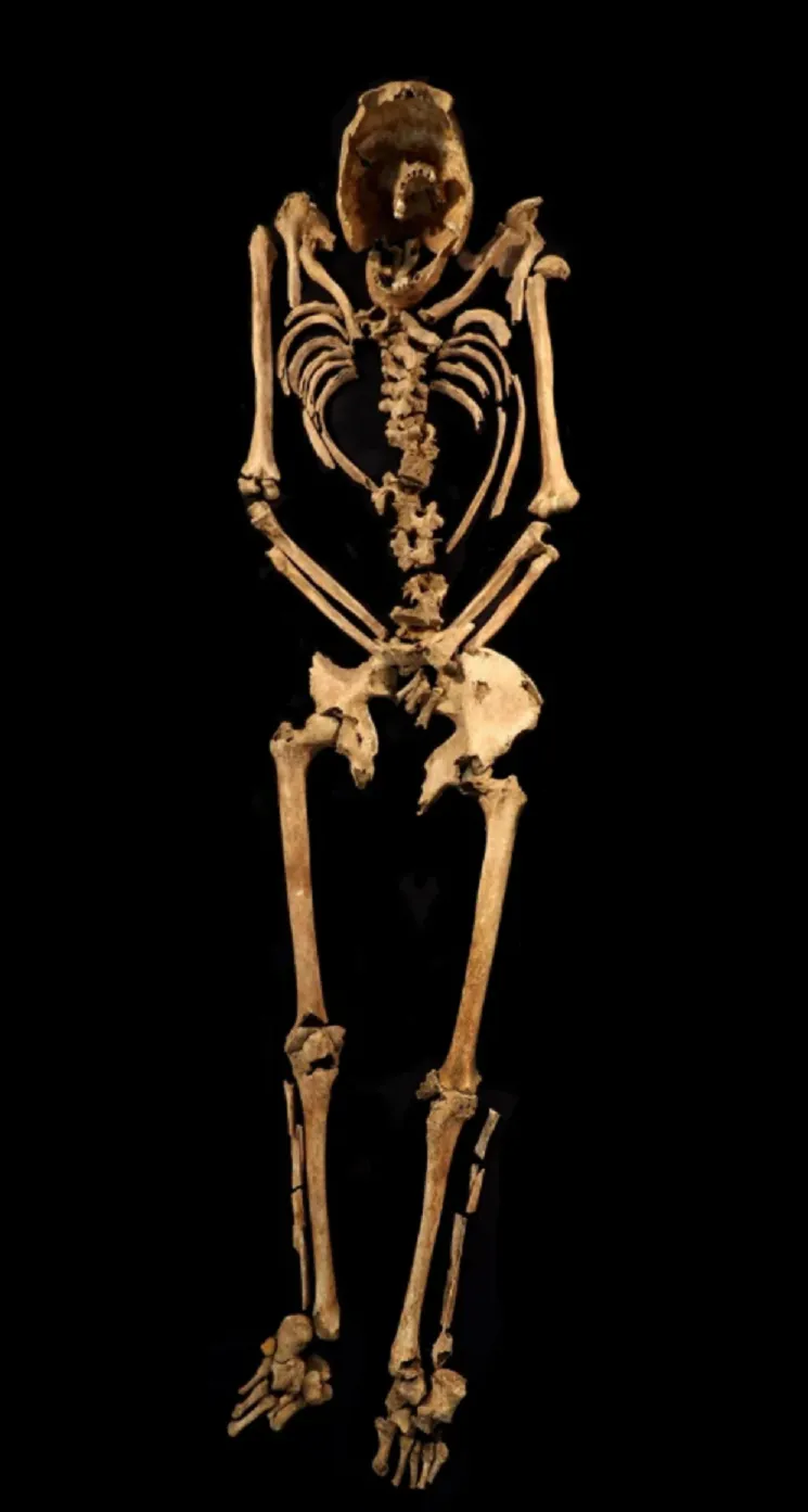Розіп'ятий скелет