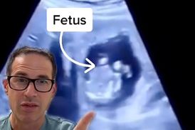 Плод развивался в печени: редкий случай внематочной беременности