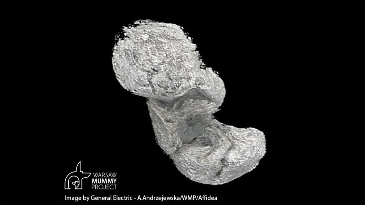 Беременный мертвец: в теле мумии обнаружили плод ребенка, которому тысячи лет Беременный мертвец: в теле мумии обнаружили плод ребенка, которому тысячи лет