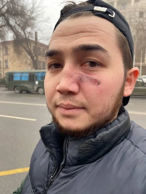 На протесті постраждав журналіст Бек Байтас