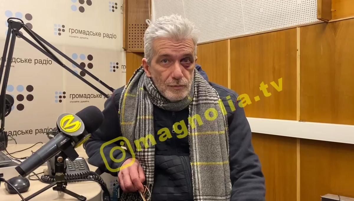 Кричали, что 90-е возвращаются: журналист Куликов рассказал подробности нападения и ограбления Кричали, что 90-е возвращаются: журналист Куликов рассказал подробности нападения и ограбления