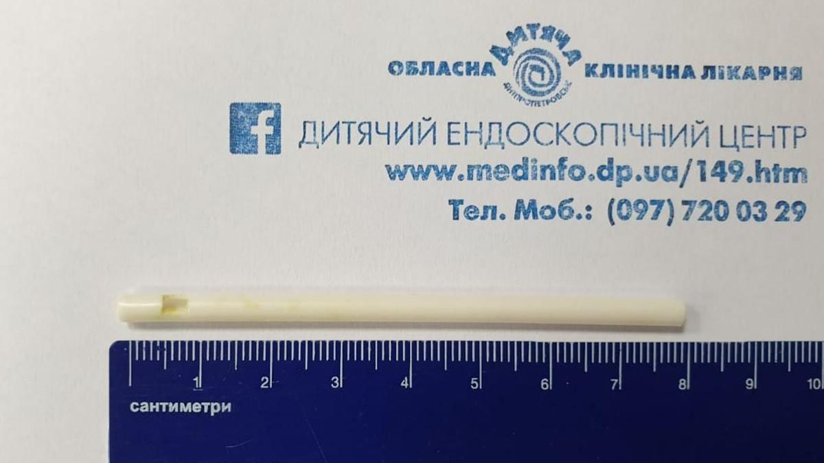 У Дніпрі дитина з'їла паличку Chupa Chups: була в тілі понад тиждень - Дніпро У Дніпрі дитина з'їла паличку Chupa Chups: була в тілі понад тиждень - Дніпро