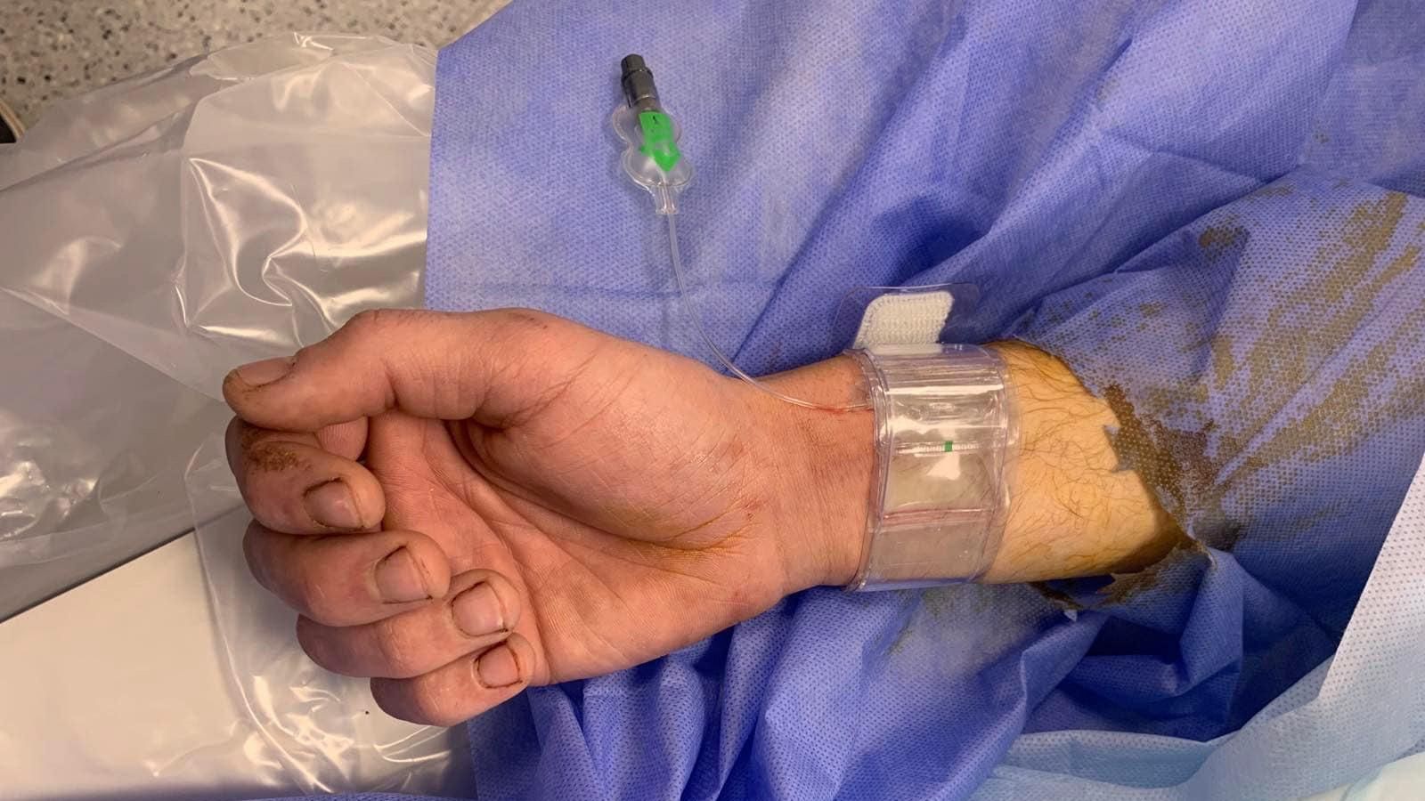 На Різдво підстрелив ворожий кулеметник: у Дніпрі хірурги дивом врятували парамедика - Дніпро На Різдво підстрелив ворожий кулеметник: у Дніпрі хірурги дивом врятували парамедика - Дніпро